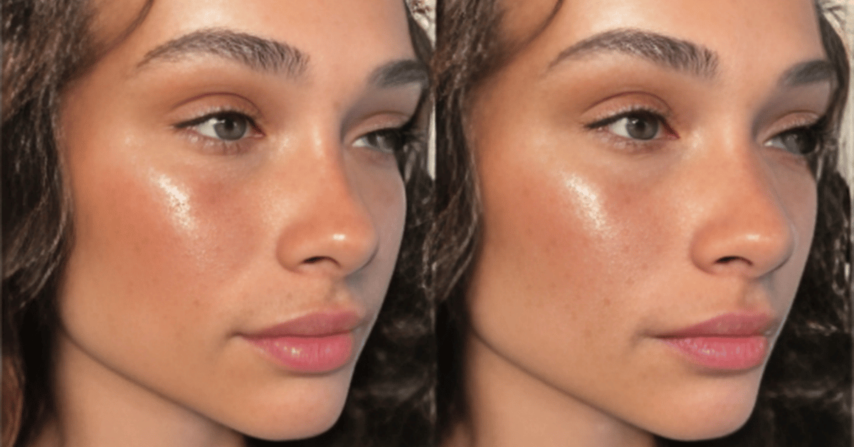 Faux Freckles Are Trending Again in Summer 2025