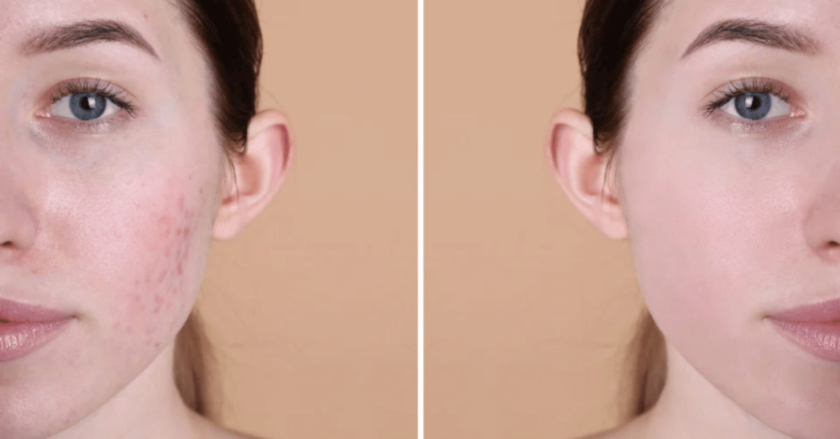 Visible Pores Are a Flex Now? Yes, Really