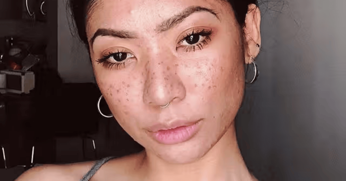 Faux Freckles, But Make Them Metallic—New Beauty Hack