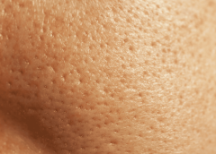 Visible Pores Are the New Filter—Own Your Texture