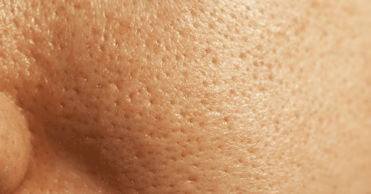 Visible Pores Are the New Filter—Own Your Texture
